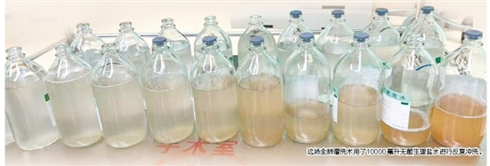 這場(chǎng)全肺灌洗術(shù)用了10000毫升無(wú)菌生理鹽水進(jìn)行反復(fù)沖洗。